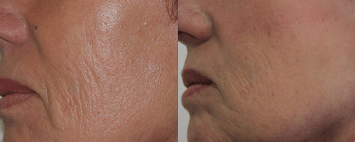 AVS PLASTIC SURGERY AND SKIN CLINIC Pudukkottai